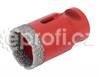 KIT EASYGRES 12 mm