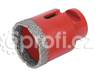 KIT EASYGRES 12 mm